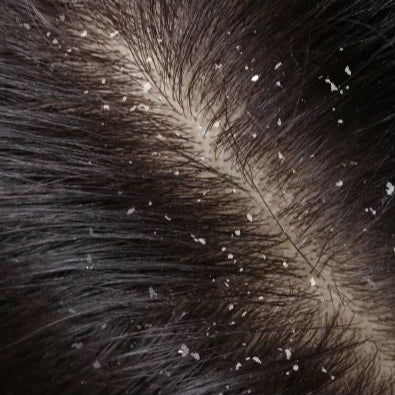 NURME - PEAT SHAMPOO - SCALP SOOTHING - 250 ml.