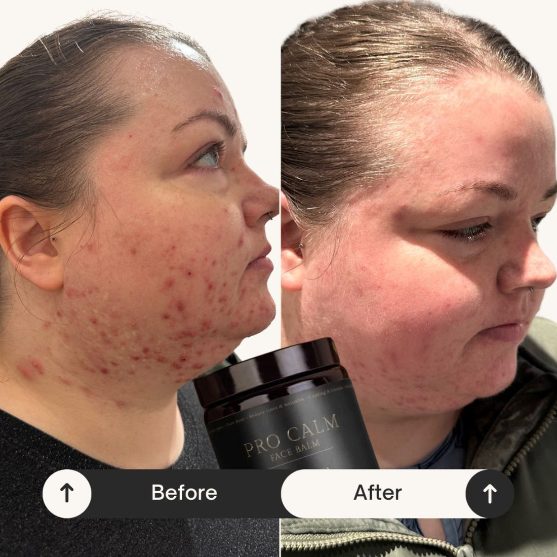 Hemmeligheden bag Pro Calm Skin Face Balm