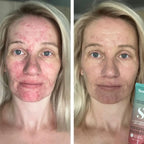 Sorted Skin - 5 in 1 Anti-Redness Day Cream SPF50 - 30 ml