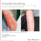 Raz Skincare - Repair Salve - 100 ml