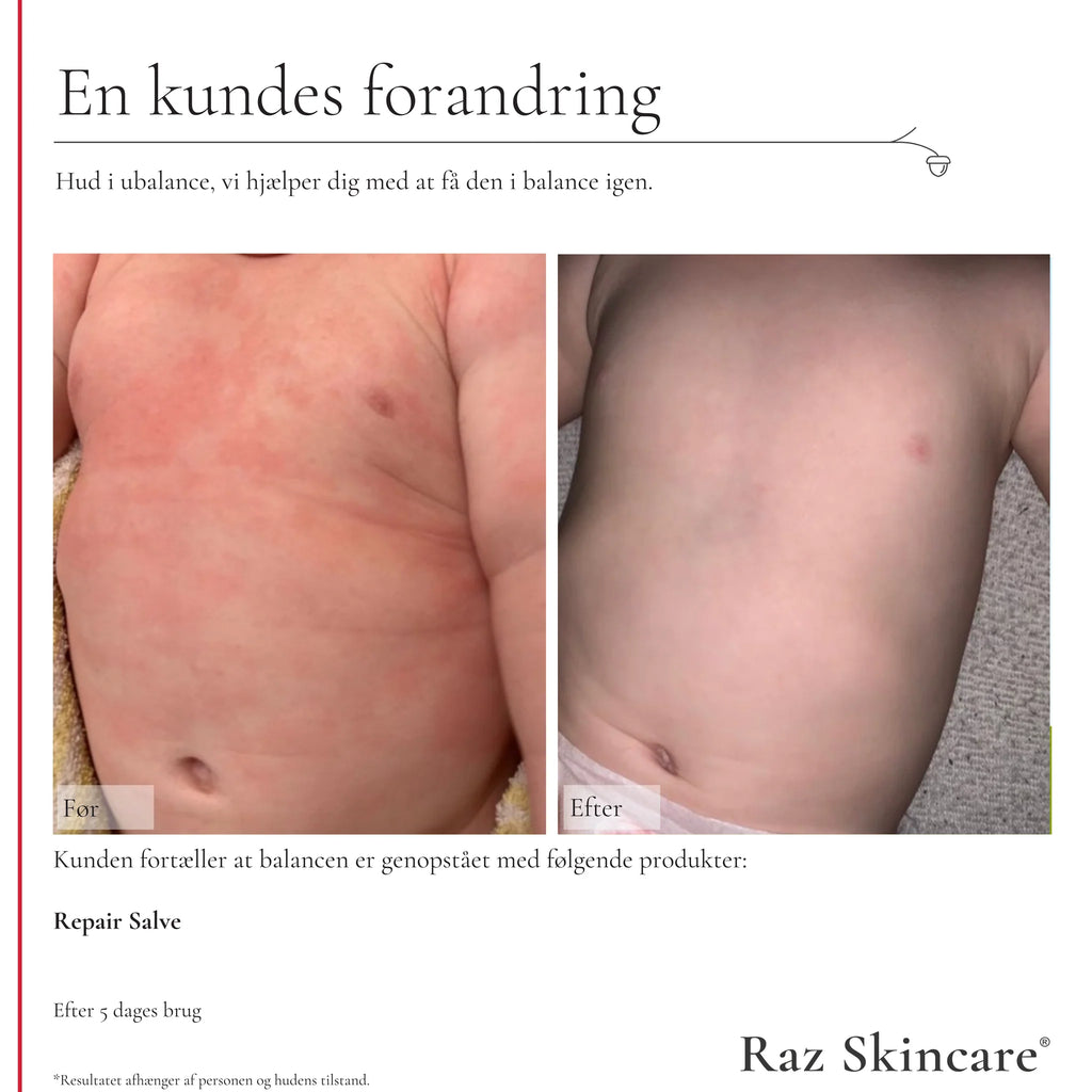 Raz Skincare - Repair Salve - 100 ml