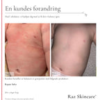 Raz Skincare - Repair Salve - 100 ml