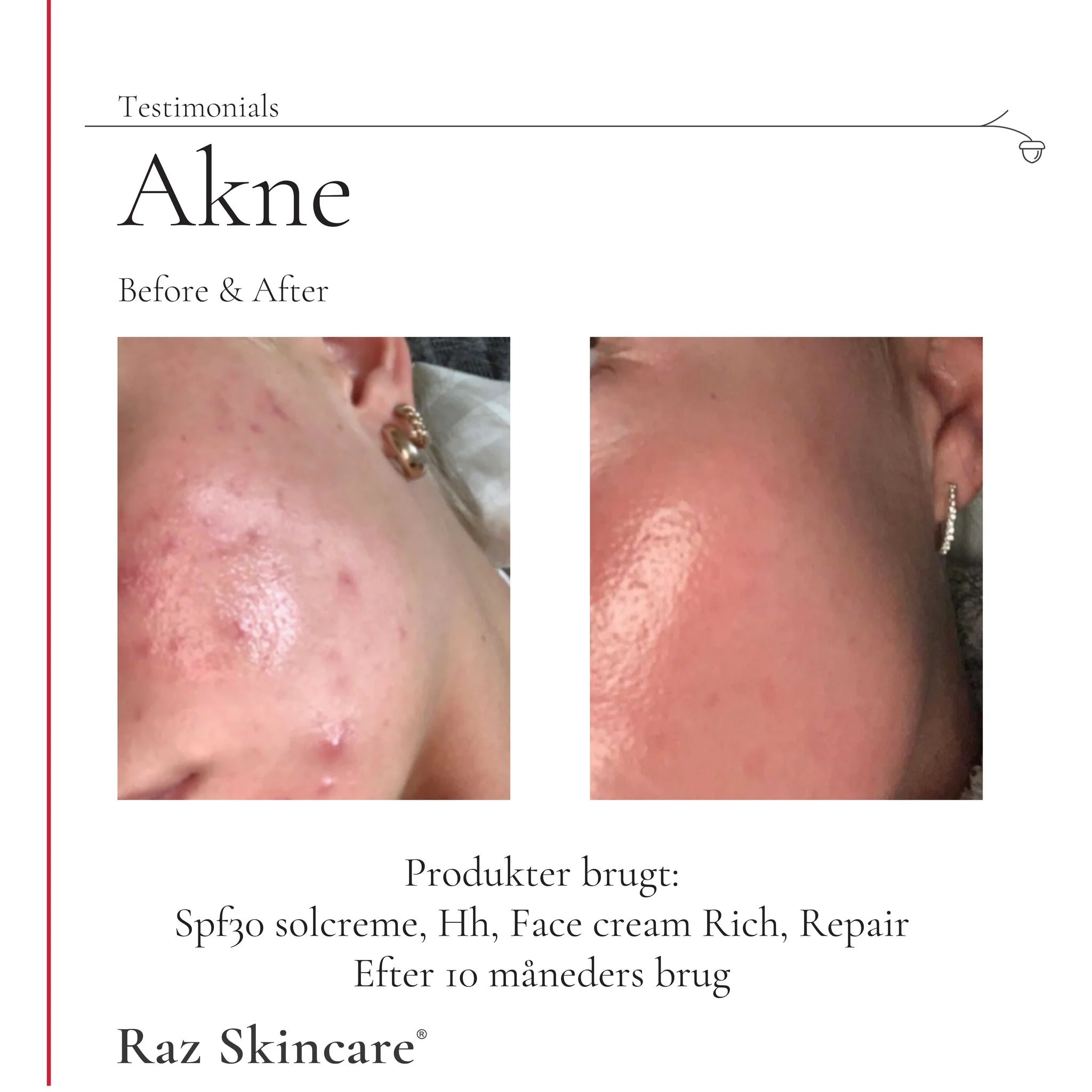 Raz Skincare - Repair Salve SPF30 - 100 ml