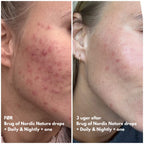 Natalie Maria Scandinavian | Calm Skin Nordic Nature drops - Hyaluronic serum