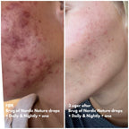 Natalie Maria Scandinavian | Calm Skin Nordic Nature drops - Hyaluronic serum