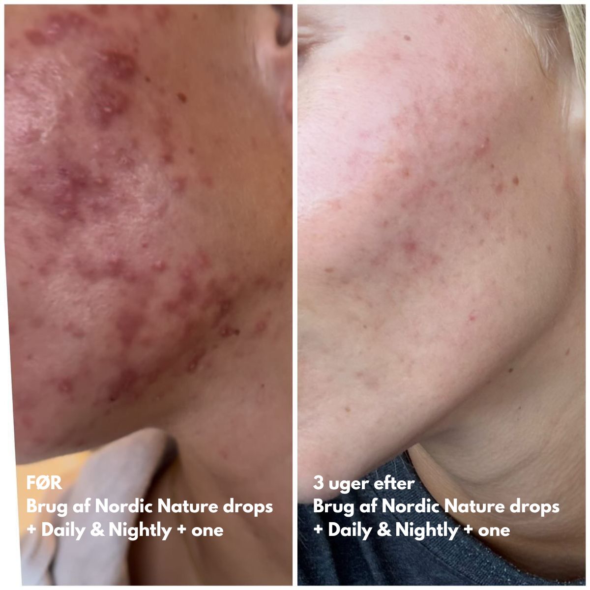 Natalie Maria Scandinavian | Calm Skin Nordic Nature drops - Hyaluronic serum