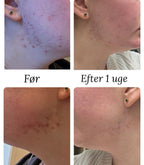 Natalie Maria Scandinavian | Nordic Nature drops - Hyaluronic serum