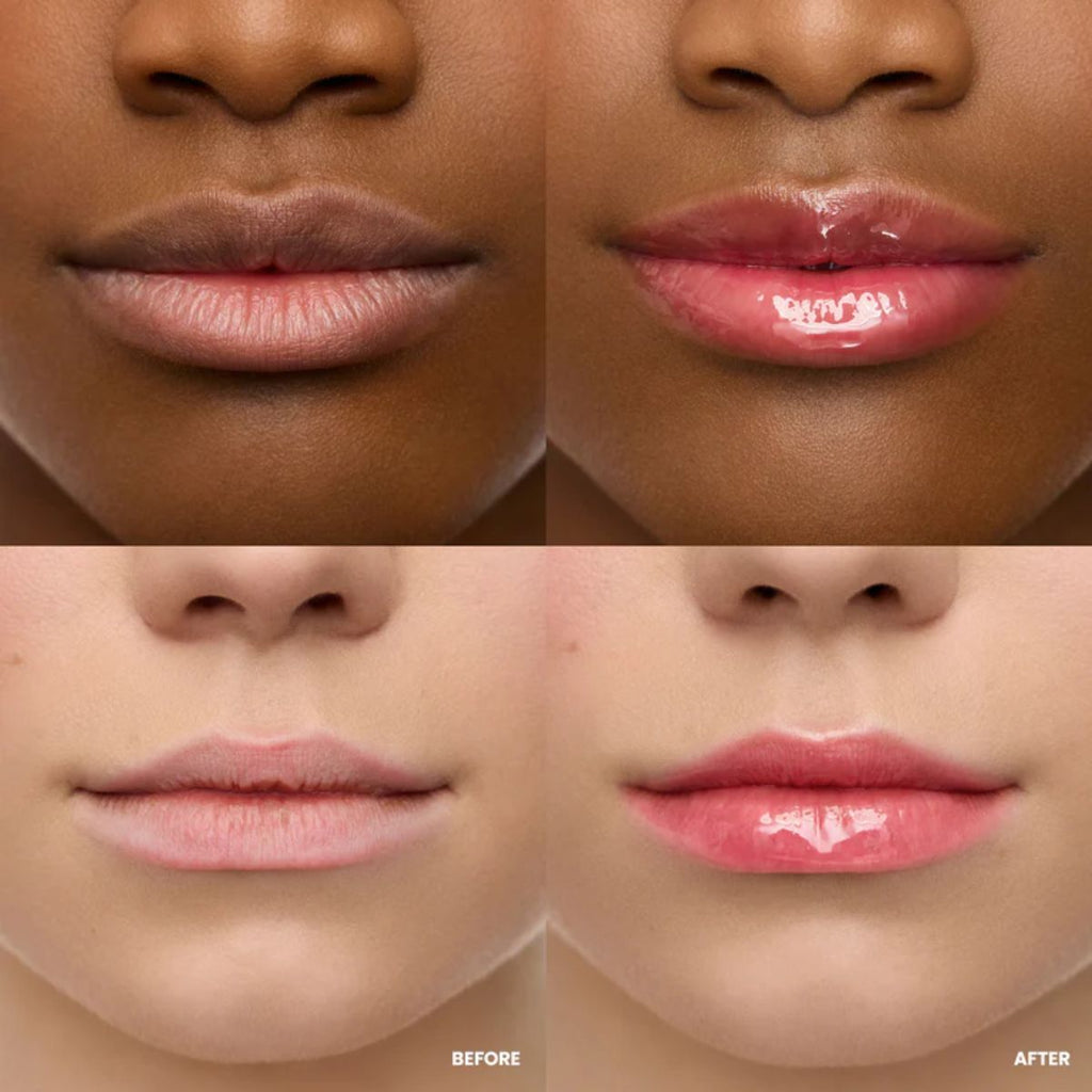 Wonderskin - Lip Rehab Serum Oil - Amour - 3.57 ml.