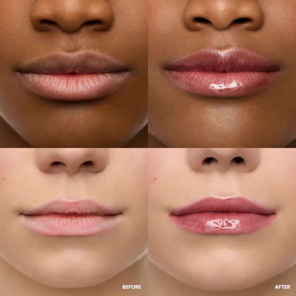 Wonderskin - Lip Rehab Serum Oil - Honey - 3.57 ml.