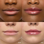 Wonderskin - Lip Rehab Serum Oil - Honey - 3.57 ml.