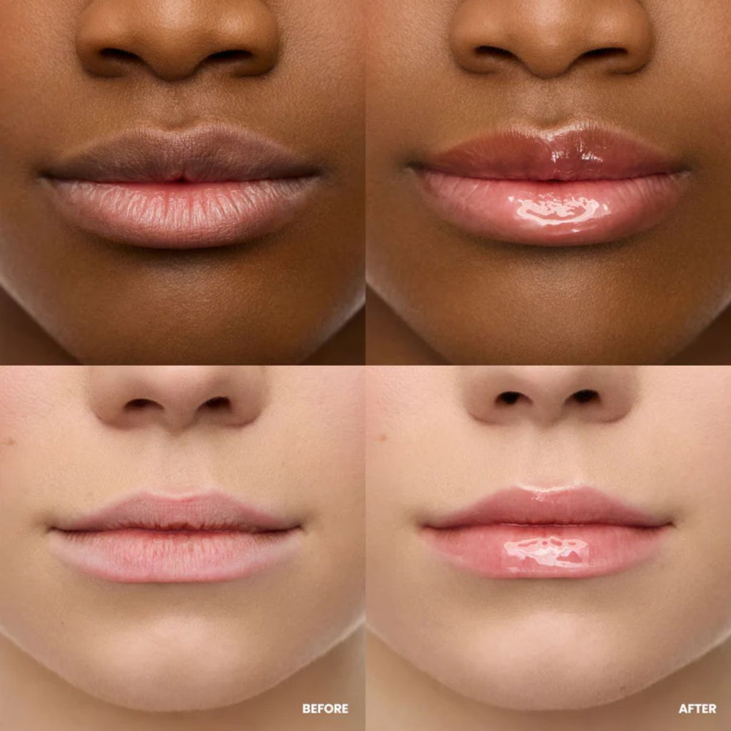 Wonderskin - Lip Rehab Serum Oil - Lover - 3.57 ml.