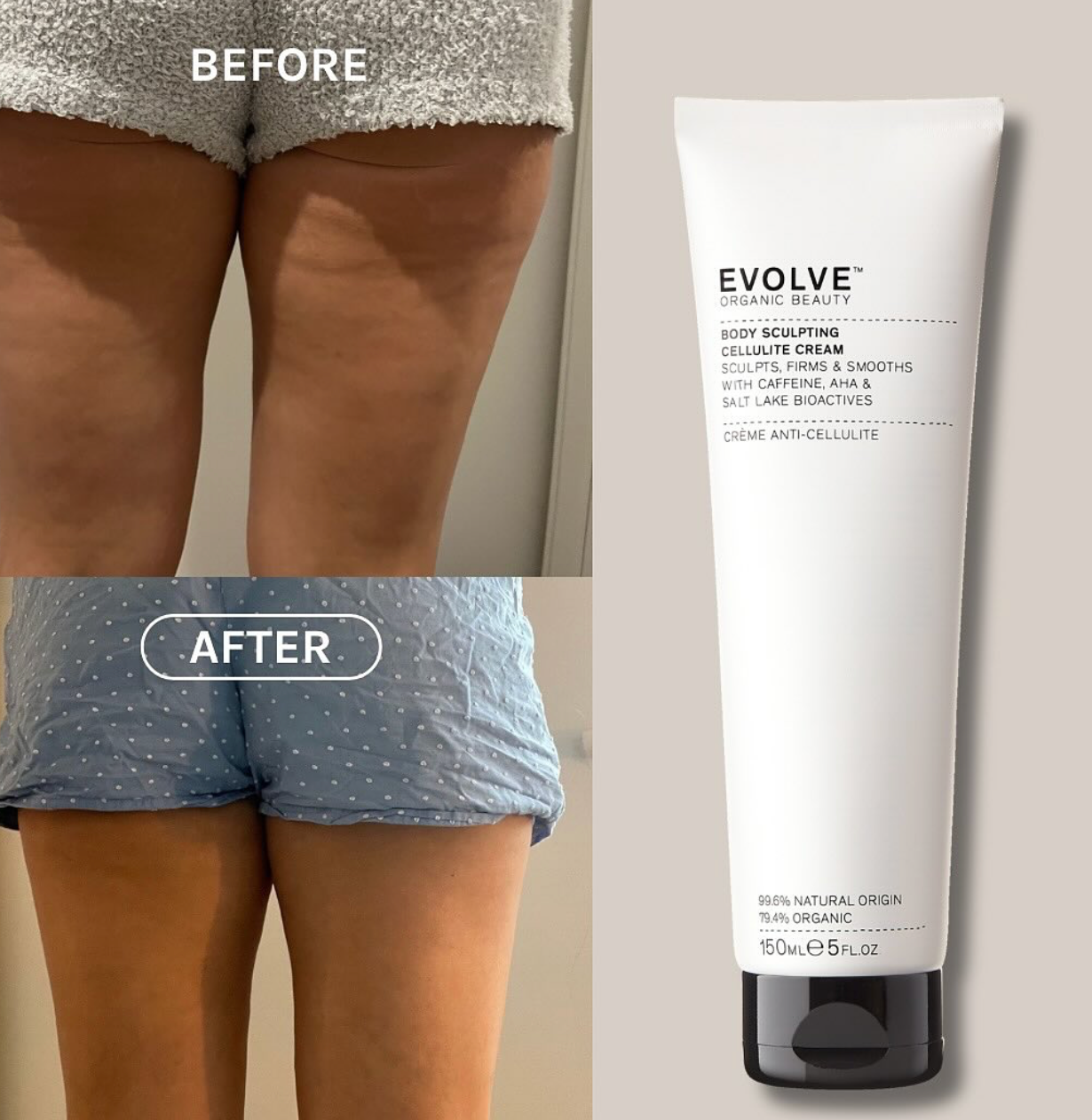 Evolve - Body Sculpting Cellulite Cream - 150 ml