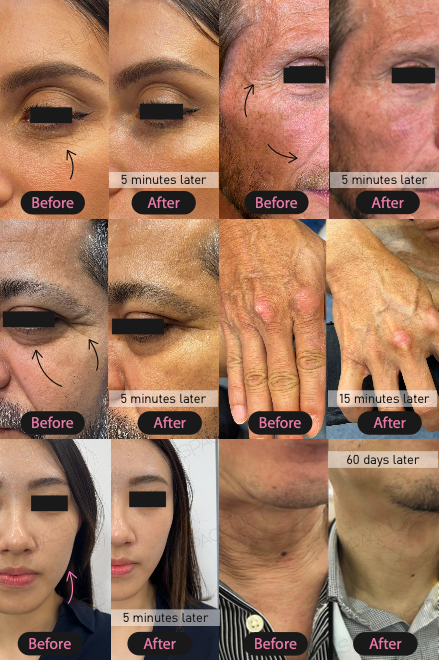 Empro - Spacelift Face Booster Lifting Spray - 30ml