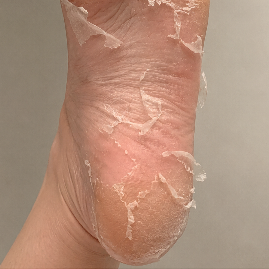 VOESH - Exfoliating Peeling Socks - 1 sæt