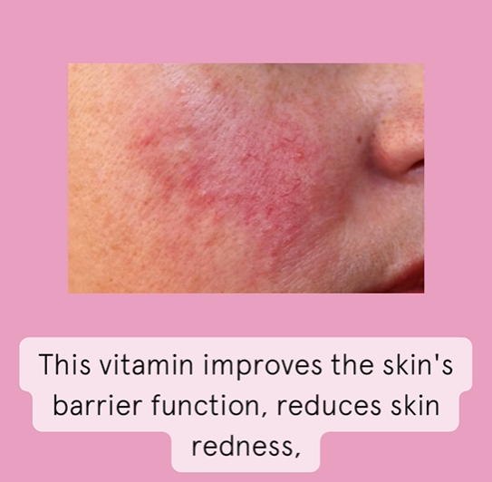 /KILI∙G/ -  probiotics - Probiotics & Niacinamide face serum - 30ml